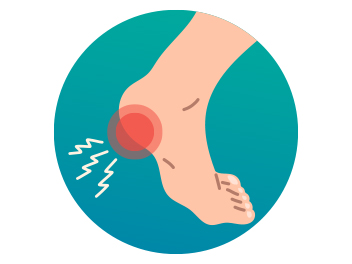 Plantar Fasciitis