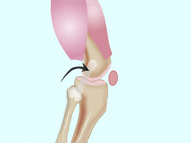 Ligaments are long, fibrous straps that fasten bones together.