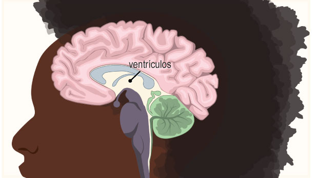 Ventricles (Spanish)