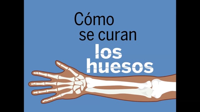 (AD) Cómo se curan las fracturas de huesos