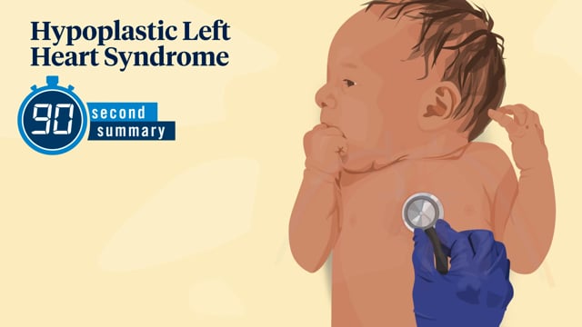 90 Second Summary: Hypoplastic Left Heart Syndrome